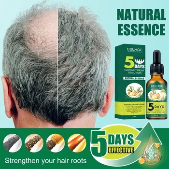 5Days Zázvor Rast Vlasov Prírodné Produkty Proti vypadávaniu Vlasov Zabrániť Liečbu Plešatosti Rýchlo Rastúcich Vyživujú Vlasy Rastu Podstate Olej