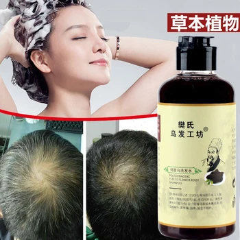 300 ml Afrike Ženy Trakciu Alopécia Liečba Rast Vlasov Produkt pre Mužov Šampón Liečbu vypadávanie Vlasov Zbaviť Parochne