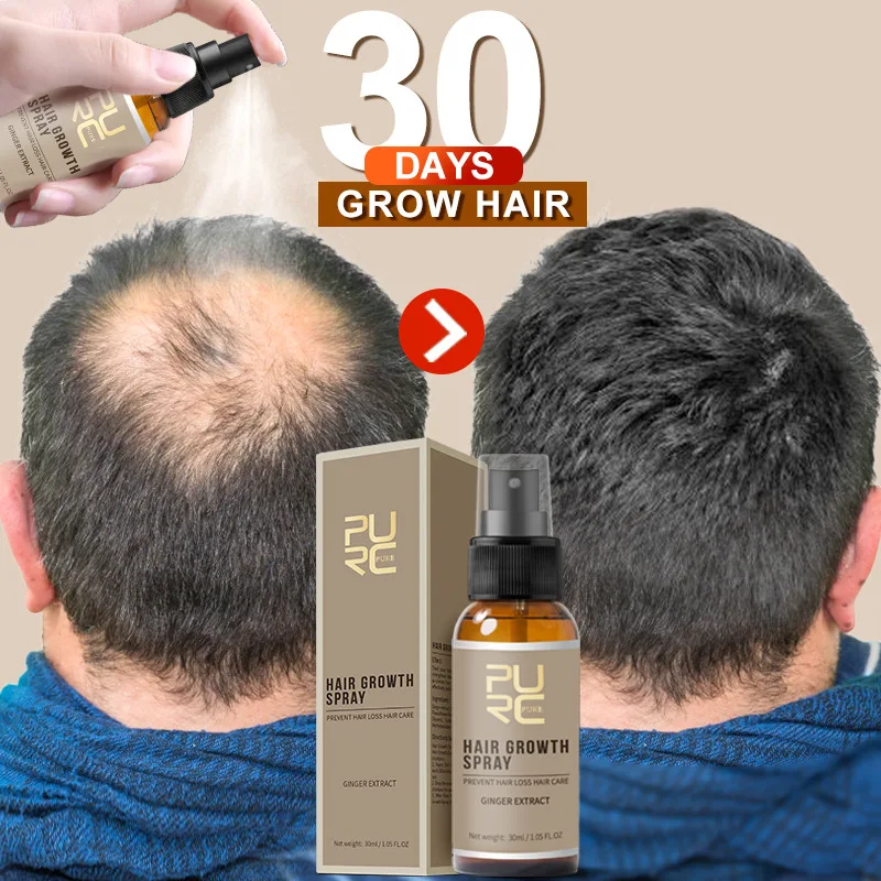 Rast vlasov Olej Anti-Hair Loss Care Sprej Mužov a Žien vlasovej Pokožky Starostlivosť o Silné Vlasy, vlasovú Pokožku, Olej Ovládanie Obrázok 4